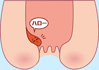 進行度１