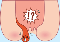 進行度１